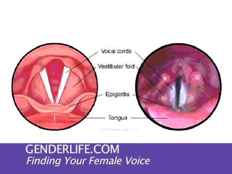 feminization