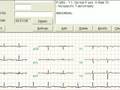 ECG recording with eClinicalWorks