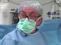 Endovascular Repair for Abdominal Aortic Aneurysm