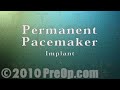 Permanent Pacemaker Implant Surgery PreOp® Patient Education free Education videos