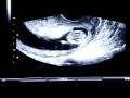 videos de 31Dec08 181