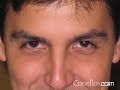 Psicosis