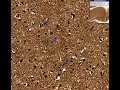 Histopathology&nbsp;Brain&nbsp;--Alzheimer&nbsp;disease
