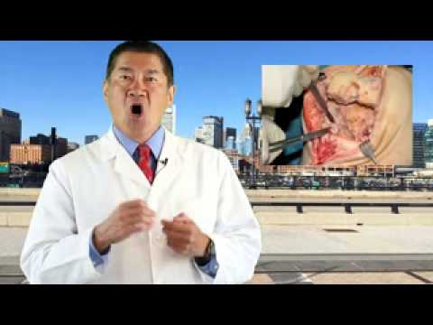 how to treat nickel allergy