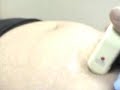 EMBARAZO DE 7.5 - PREGNANCY 7.5 WEEKS- PELVIC SCAN