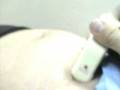 videos de EMBARAZO DE 7.5 - PREGNANCY 7.5 WEEKS- PELVIC SCAN