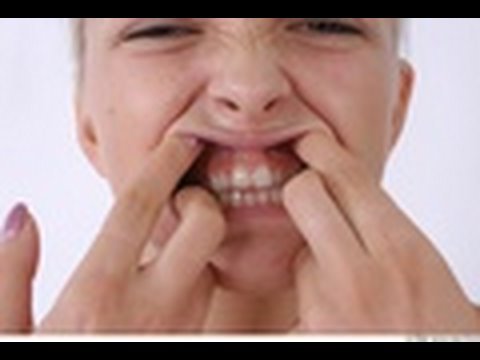 how to relieve grinding teeth