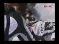 Avalanche Buries Snowmobile Rider!