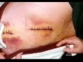 1997 North Hollywood Shootout part 2.2