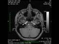 videos de Brain scan MRI Series 1