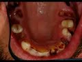 Las drogas en el Sistema Dentario