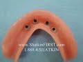 Mini Dental Implants - Denture Stablization Video III Mini Dental Implants - Denture Stablization Video III