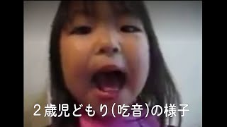 2歳児のどもり(吃音)動画