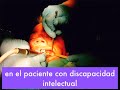 Anestesia en Discapacitados Ps�quicos en Cirug�a oral Mayor