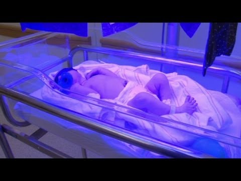 how to cure jaundice for newborn baby