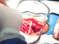 Cirurgia de coluna Cirurgia de coluna