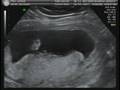 videos de Baby Midkiff 5 of 5
