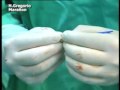Implantan una v�lvula pulmonar a trav�s de stent
