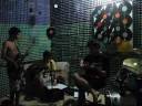 Banda SDT-Scar Tissue