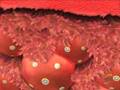 Nasodren for sinusitis treatment