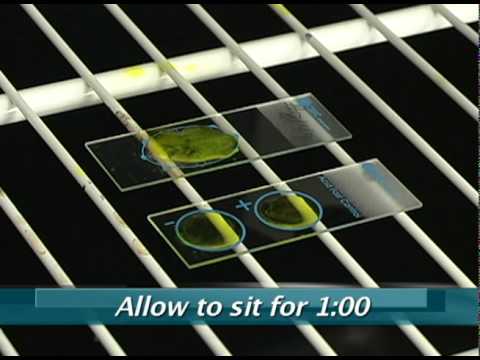 how to collect afb sputum
