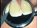 Dental Profession & Apple
