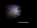 ILM peeling.wmv
