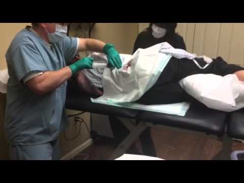 how to harvest stem cells