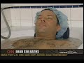 Dead Sea salt therapy for psoriasis - on CNN\