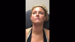 Get rid of that "double chin" permanently with Kybella!!!