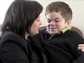 Hunter Syndrome