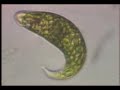 Protist Protist