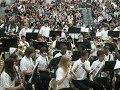 Click here to watch this video Canarelli MS Band 