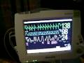videos de Enna at the hospital 253