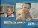 Kate & Mia on NBC  Cancer Acute myelogenous leukemia