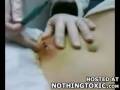 stomach explodes