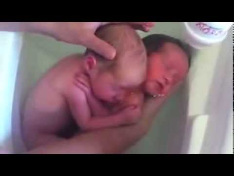 Nou-nascuti gemeni ce au impresia ca inca sunt in pantec