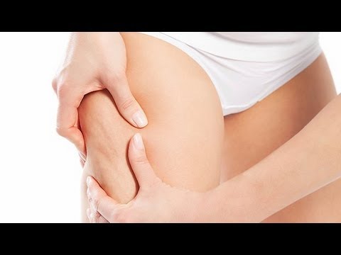 how to eliminate upper thigh fat