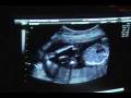videos de Sonogram