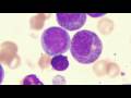 videos de Insidermedicine in 60 - January 7, 2009