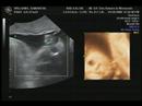 Baby Jake 28 Week 3D/4D Ultrasound