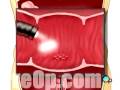 videos de Malpractice Medical Endoscopy of Large Intestine 4