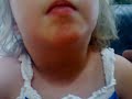 emma neck