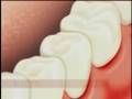 Higiene bucal - Máxima Odontologia