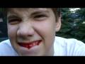 Blood Fx Test