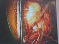 self-heart-surgery.html