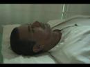 Acupuntura - Paralisia Facial e Estética Facial