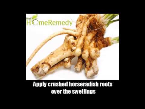 how to cure chilblains