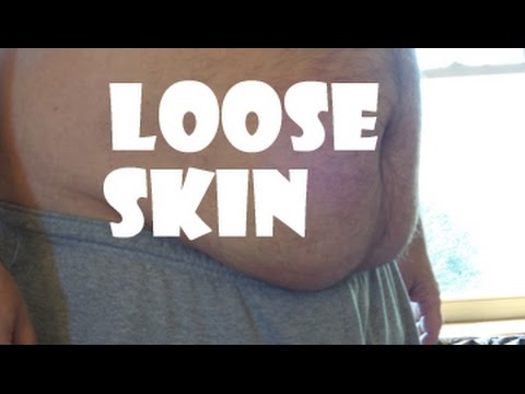 how to avoid loose skin