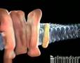 Epilepsia, una gran desconocida